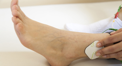 Après un AVC : l'apport de l'électrostimulation Après un AVC : l'apport de l'électrostimulation