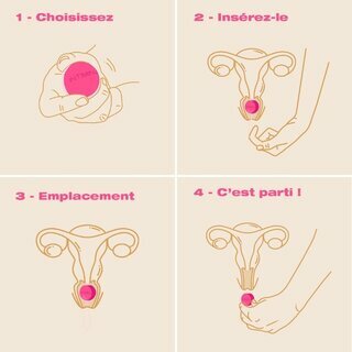 Tr�s faciles � mettre ! les perles d'exercices Laselle vous aideront � reprendre le contr�le de votre p�rin�e