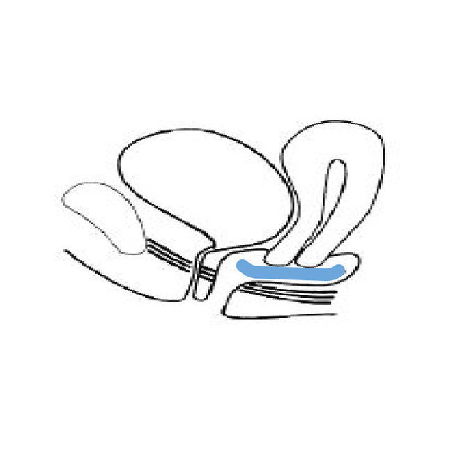 Comment utiliser un pessaire bol à tamis perforé