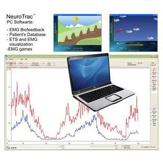 Capture d'écran du logiciel Neurotrac
