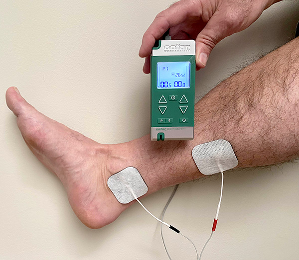 Stimulation du nerf tibial postérieur pour l'instabilité vésicale