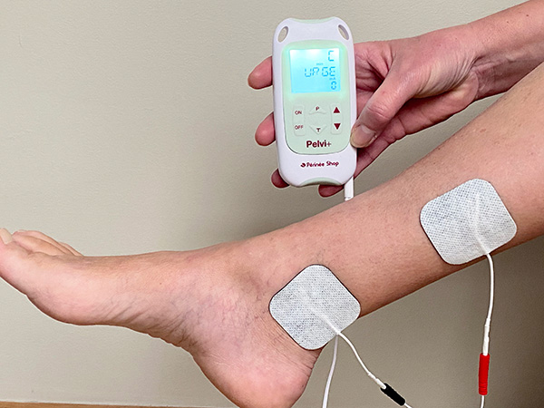 Stimulation du nerf tibial postérieur pour l'hyperactivité vésicale