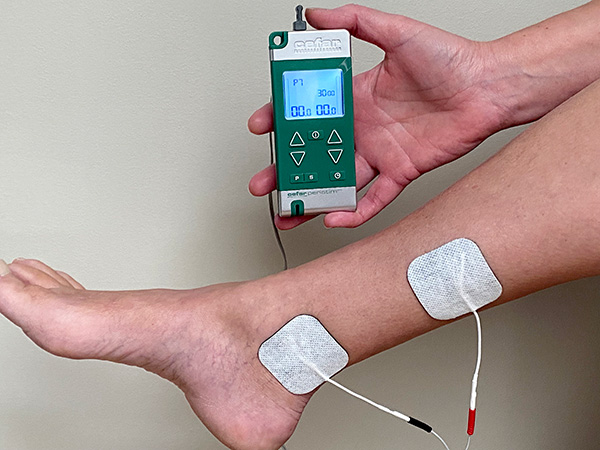 Stimulation du nerf tibial posterieur avec le peristim pro