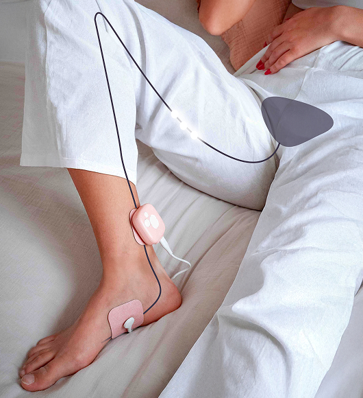 La stimulation du nerf tibial postérieur