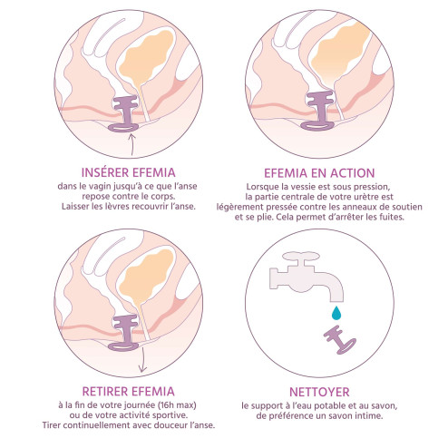 comment fonctionne EFEMIA le pessaire pour aider à stopper les fuites urinaires