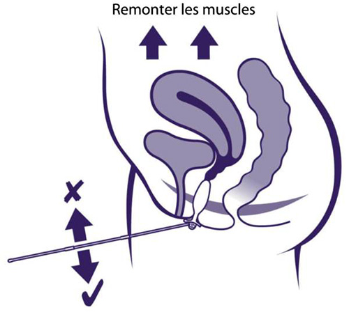 Contracter les muscles du périnée pendant les séances d'electrostimulation pour savoir si l'on contracte correctement
