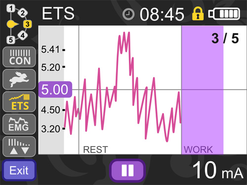 Graphique ETS - stimulation déclenchée après le seuil du biofeedback atteint