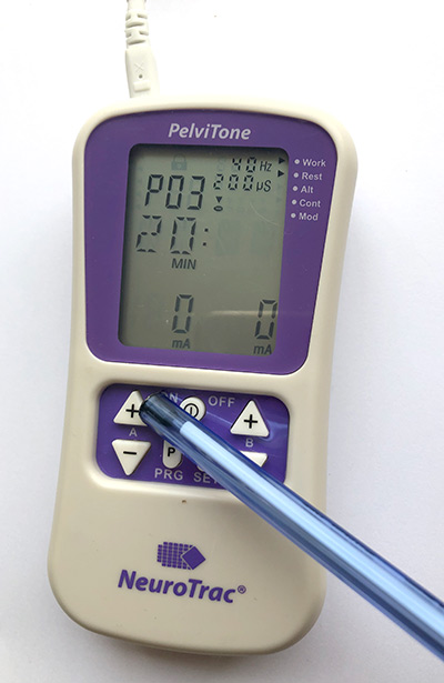 https://www.perineeshop.com/imgfck/181/Image/PAGES-web/intensite-electrostimulateur-perineal.jpg