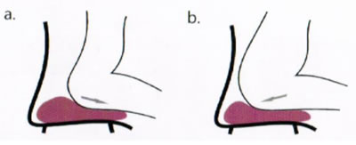 Exercice pour le périnée 1