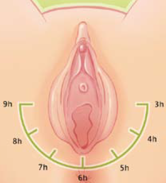 Massage externe du périnée - positionnement des doigts