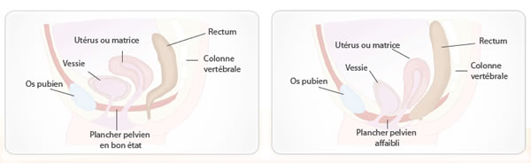 Vue en coupe du plancher Pelvien