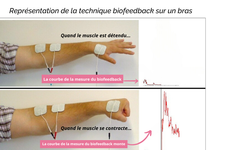 Le principe du biofeedback