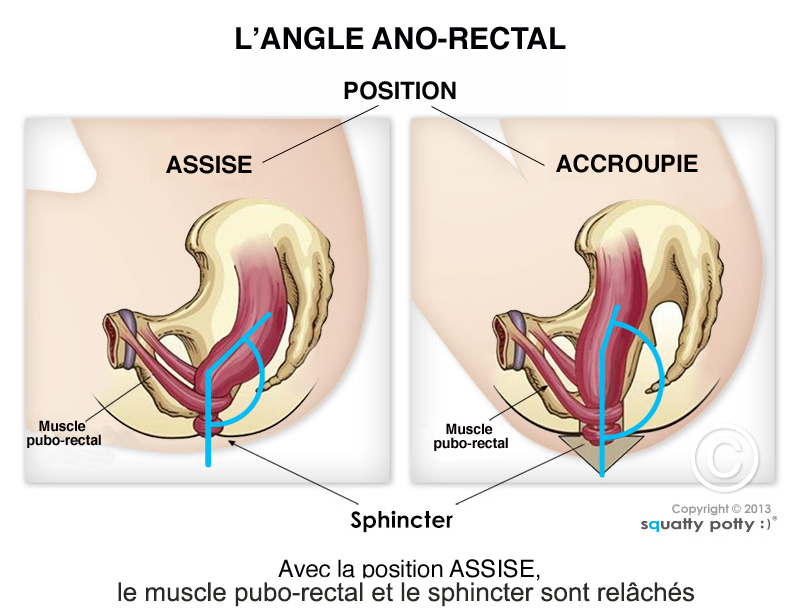 La bonne position aux toilettes pour soulager une constipation